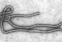 ebola virus [PD-USGov-HHS-CDC]