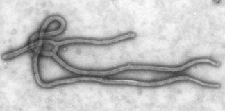 ebola virus [PD-USGov-HHS-CDC]