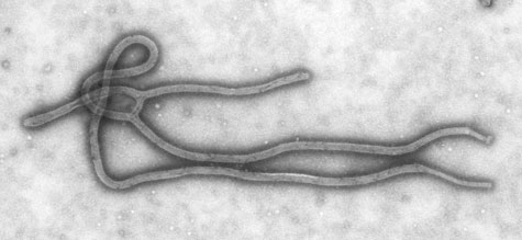 ebola virus [PD-USGov-HHS-CDC]